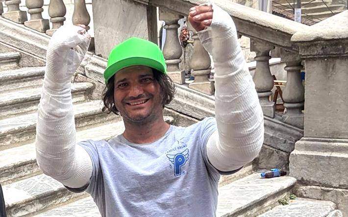 “La scintilla e subito il fuoco. Sono in ospedale ho le braccia ustionate e 10 anni di lavoro in fumo”